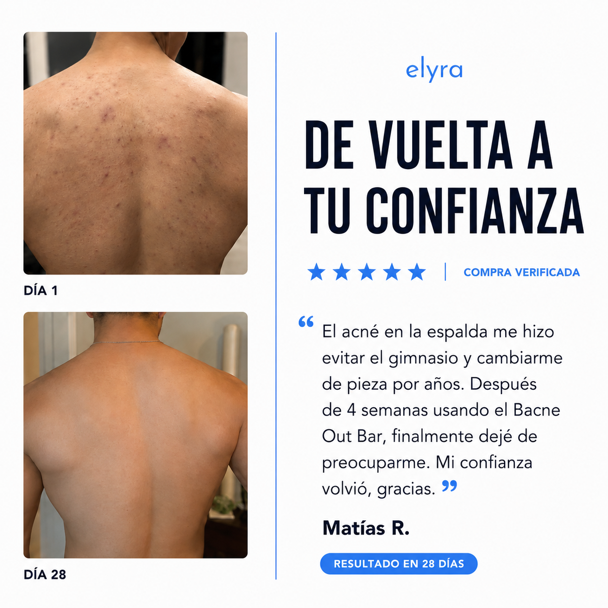 Elyra barra natural para combatir el acné corporal