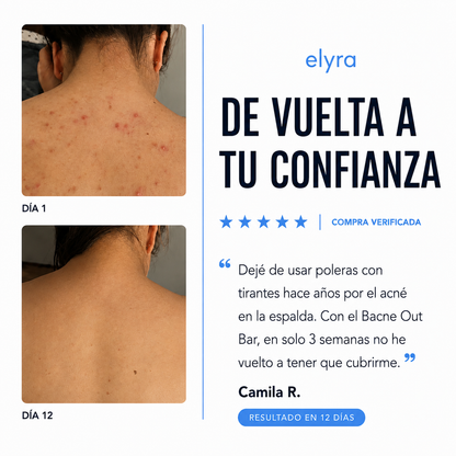 Elyra barra natural para combatir el acné corporal