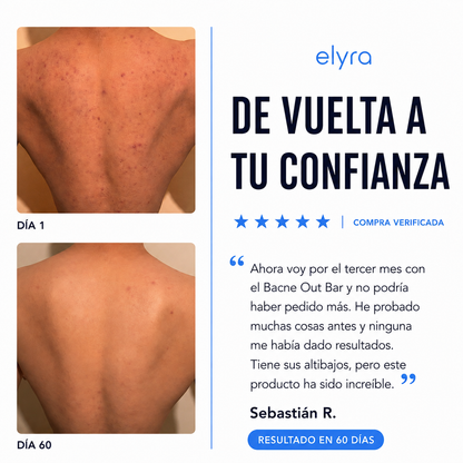 Elyra barra natural para combatir el acné corporal