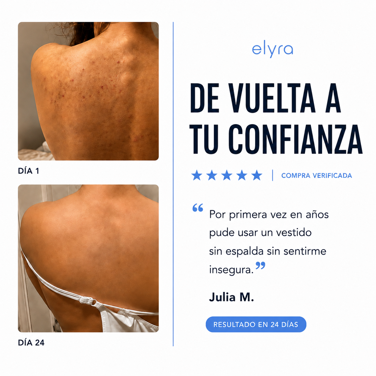 Elyra barra natural para combatir el acné corporal