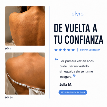 Elyra barra natural para combatir el acné corporal